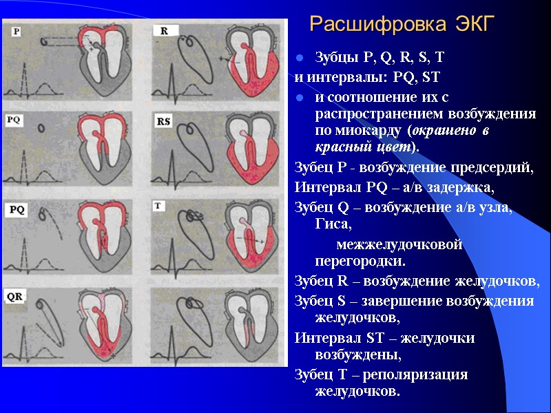 Расшифровка ЭКГ Зубцы P, Q, R, S, T  и интервалы: PQ, ST и
